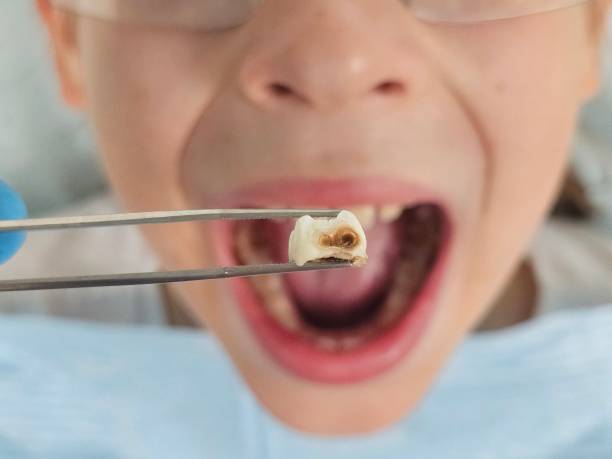 Best Emergency Dentist for Knocked-Out Tooth in Baileys Crossroads, VA